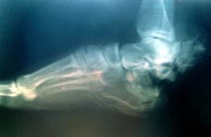 X-ray from injury claim for compensation