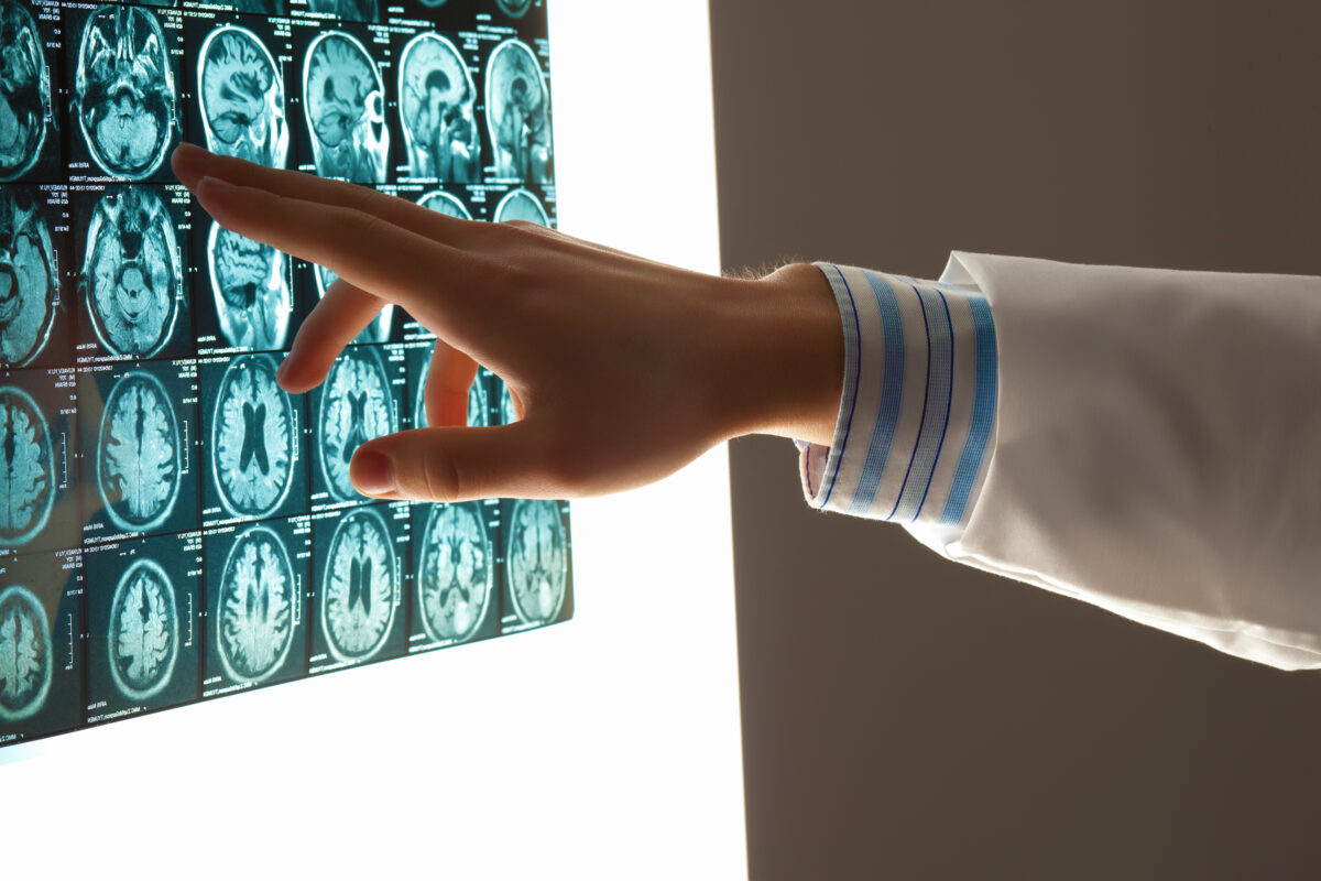 Idaho Traumatic Brain Injury Lawsuits: What You Need to Know